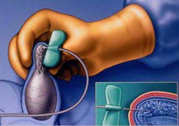 2026科学助孕：全方位提升试管婴儿与辅助生殖成功率的实操攻略