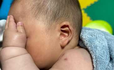 2026年解析卵巢囊肿对怀孕的影响及代生代怀辅助生殖注意事项